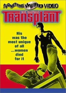 The Amazing Transplant