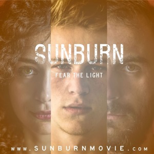 Sunburn